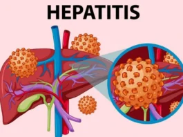 Hepatitis