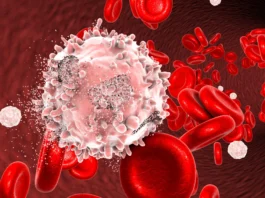 Leukemia