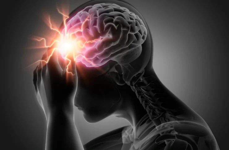 Stroke