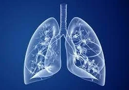 cystic fibrosis