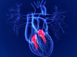 heart-related conditions